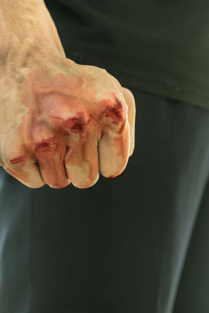 A person's bloody fist after an domestic assault